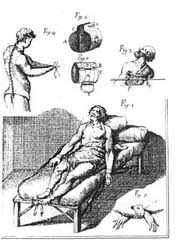 restraints